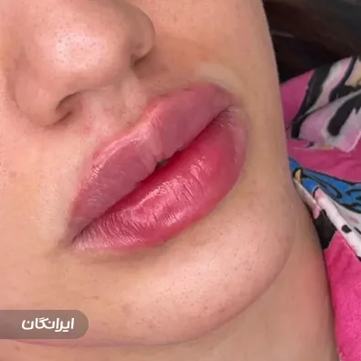 کلینیک زیبایی الناز