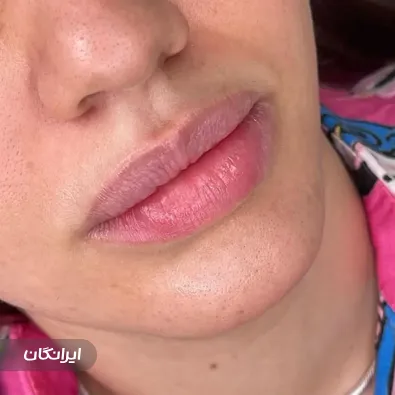 کلینیک زیبایی الناز