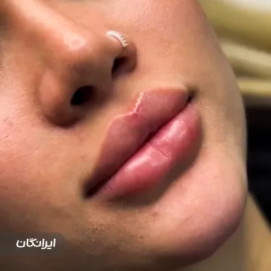 کلینیک زیبایی نگارسنتر