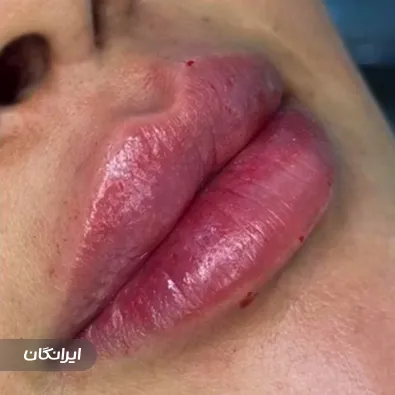 کلینیک زیبایی نگارسنتر