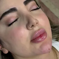 کلینیک زیبایی مهرسا