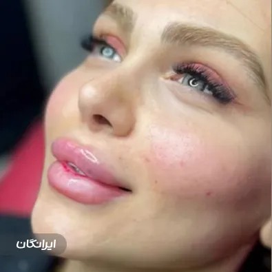 کلینیک زیبایی مهرسا