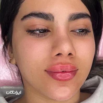 کلینیک زیبایی مهرسا