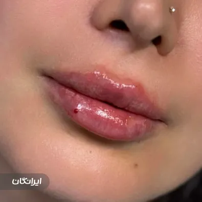 کلینیک زیبایی دکتر نسترن کاکه خانی