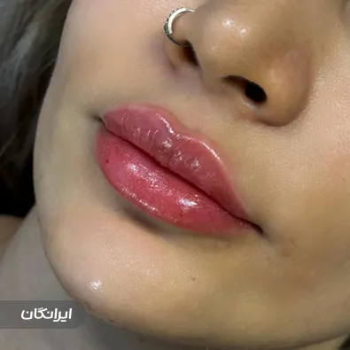 کلینیک زیبایی دکتر نسترن کاکه خانی