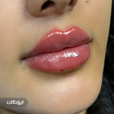 کلینیک زیبایی دکتر نسترن کاکه خانی