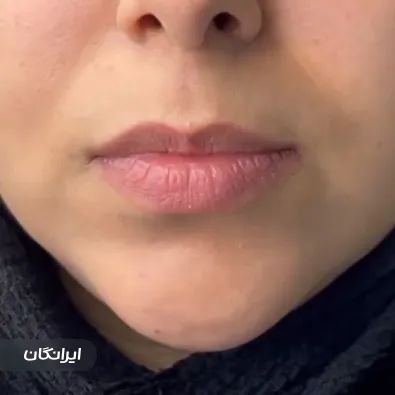 کلینیک زیبایی دلی هرمون