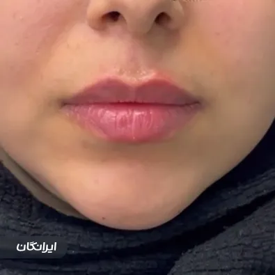 کلینیک زیبایی دلی هرمون