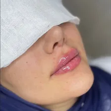 کلینیک زیبایی مینا