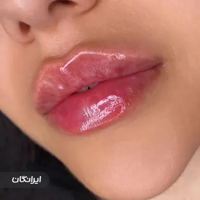 کلینیک زیبایی مینا