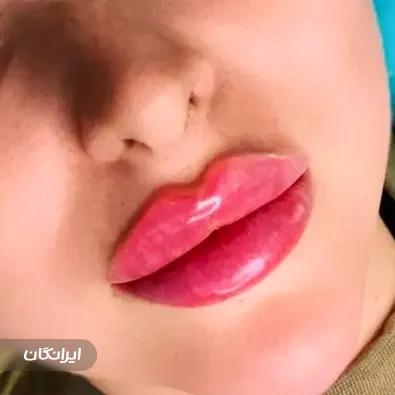 کلینیک زیبایی فرشته محبی