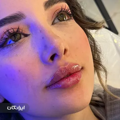 کلینیک زیبایی دکتر محمد ایلخانی