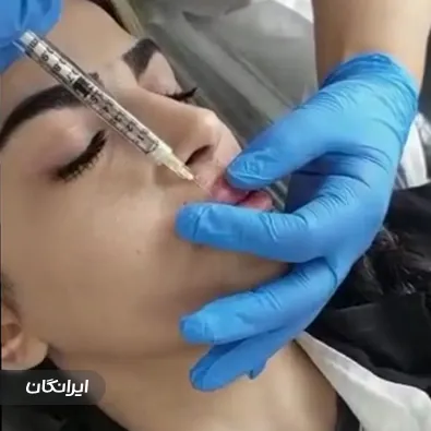 فیشیالیست سپیده ملکی