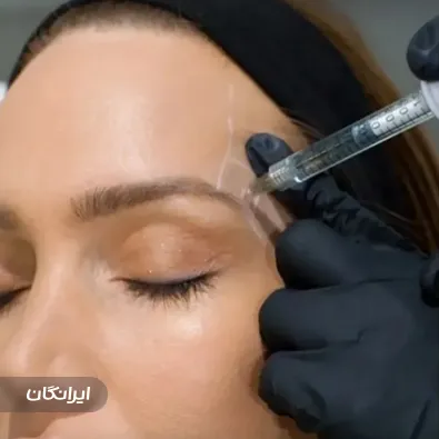 فیشیالیست سپیده ملکی