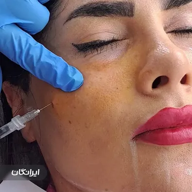 فیشیالیست سپیده ملکی