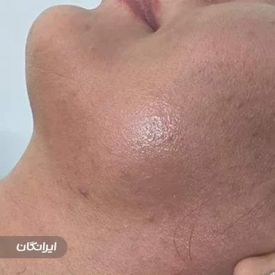 مطب لاغری و زیبایی مدی لایف