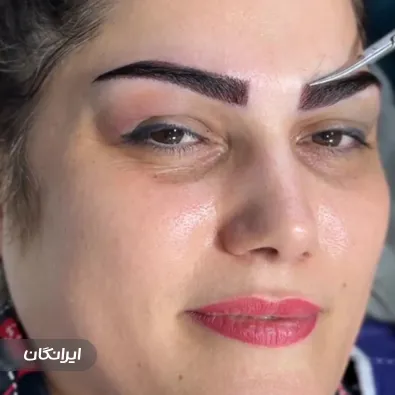 کارشناس کاشت مو فائزه نظامیوند