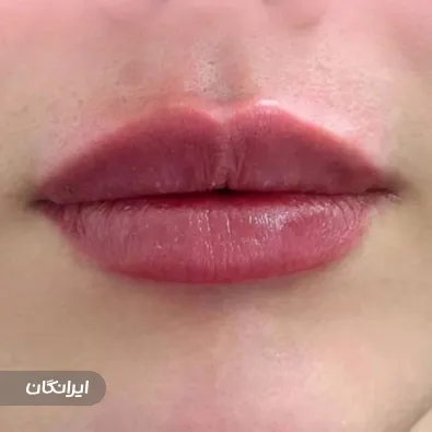 کلینیک زیبایی نوفا