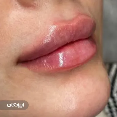 کلینیک زیبایی نوفا