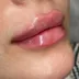 کلینیک زیبایی نوفا