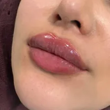 کلینیک زیبایی نوفا