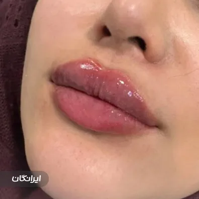 کلینیک زیبایی نوفا