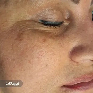 فیشیالیست سونیا ناصری