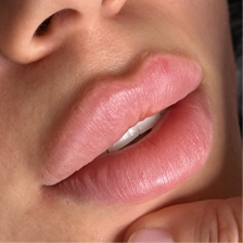 کلینیک زیبایی ایران مهر