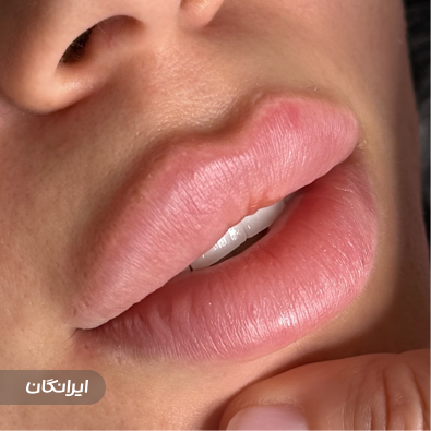 کلینیک زیبایی ایران مهر