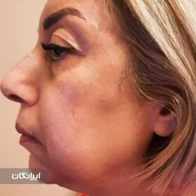 کلینیک زیبایی مایا