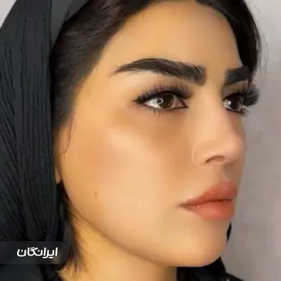 کلینیک زیبایی روژه