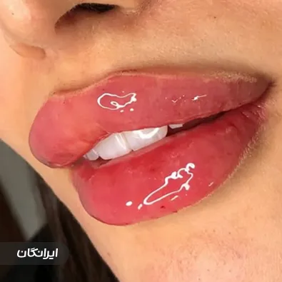 کلینیک زیبایی هنیا