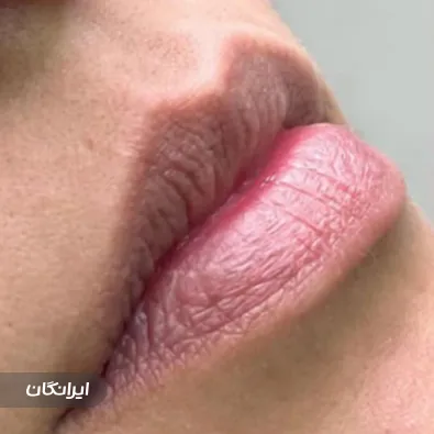 کلینیک زیبایی هنیا