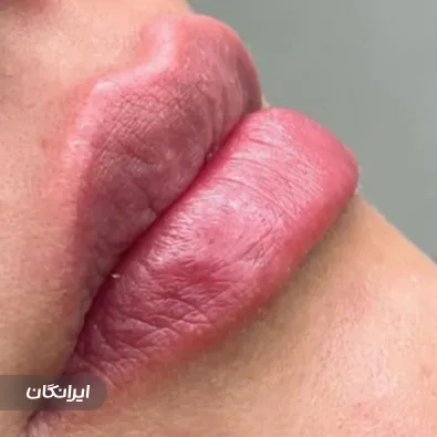 کلینیک زیبایی هنیا