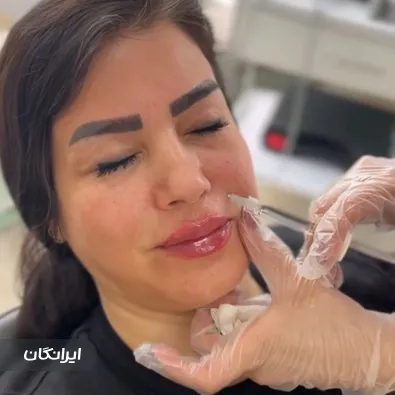 کلینیک زیبایی آسو