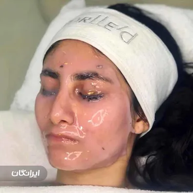 فیشیالیست شیما داوطلب