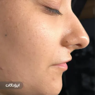 فیشیالیست تکتم رئوف