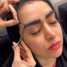 کارشناس کاشت مو شهنویی