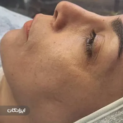 سالن مراقبت پوستی مهتاب