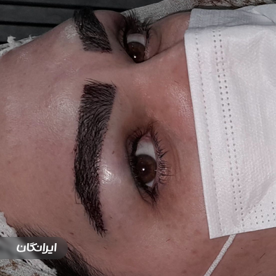 کارشناس کاشت مو سارا موذن