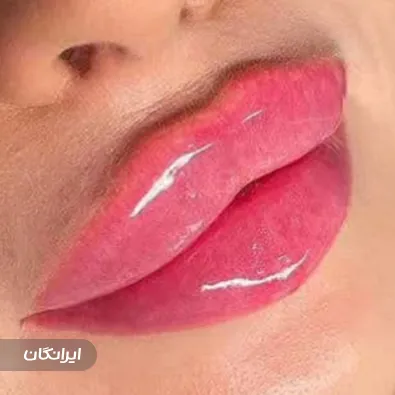 کلینیک زیبایی النا