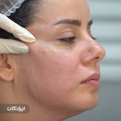 کلینیک زیبایی فرین