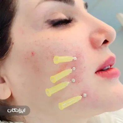 کلینیک زیبایی پریان