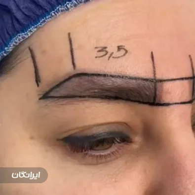 کارشناس کاشت ابرو سمیرا فیضی