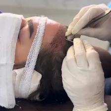 کارشناس کاشت ابرو سمیرا فیضی