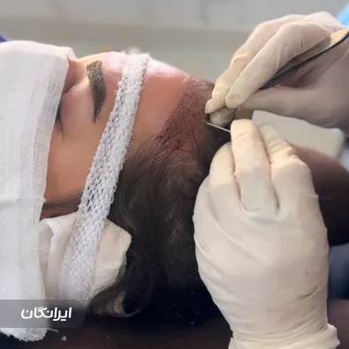 کارشناس کاشت ابرو سمیرا فیضی