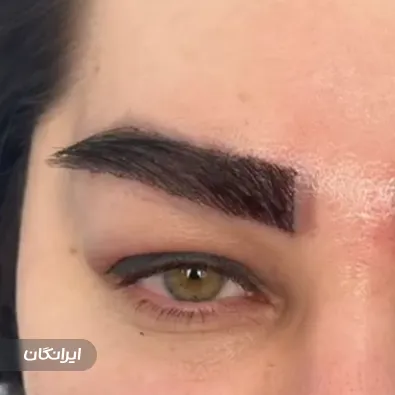 کارشناس کاشت ابرو سمیرا فیضی