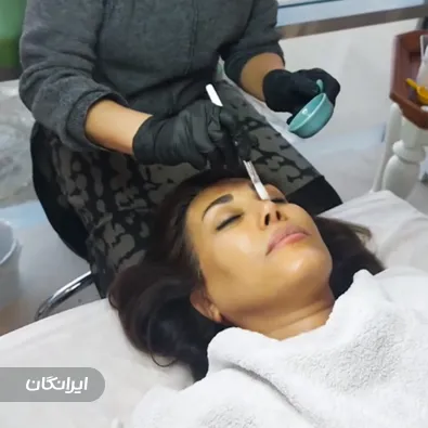 فیشیالیست لیلی فعلی