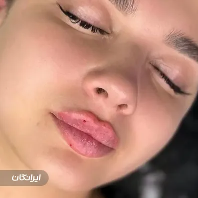 کلینیک زیبایی بیوتی فیس