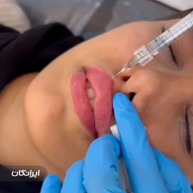 کلینیک زیبایی ژلوکس